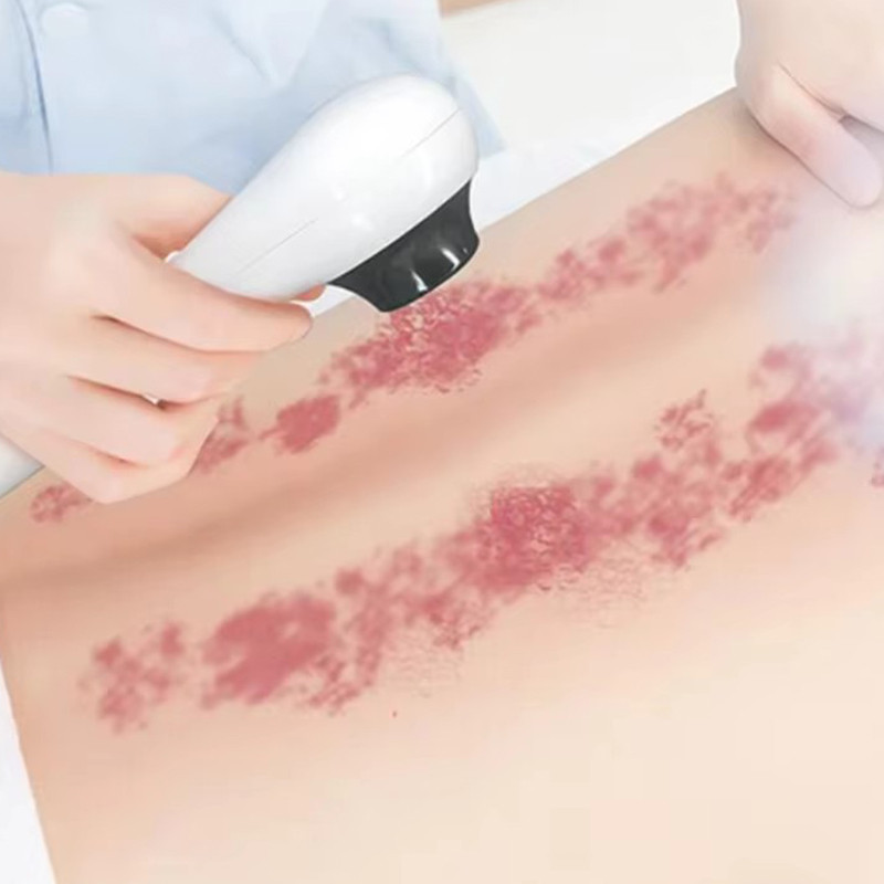 Portable RF Vacuum Cavitation Ccooling Double Chin Removal Face Lifting Skin Firmming Beauty Machine