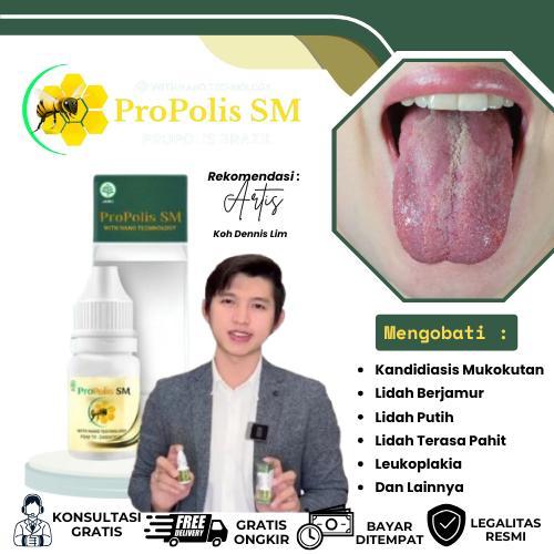 Obat Kandidiasis Mukokutan, Lidah Putih Berjamur, Lidah Terasa Pahit, Mati Rasa, Lidah Perih