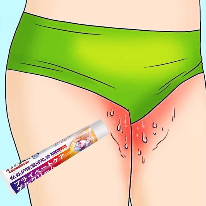 krim gatal gatal kulit salep gatal selangkangan 30g