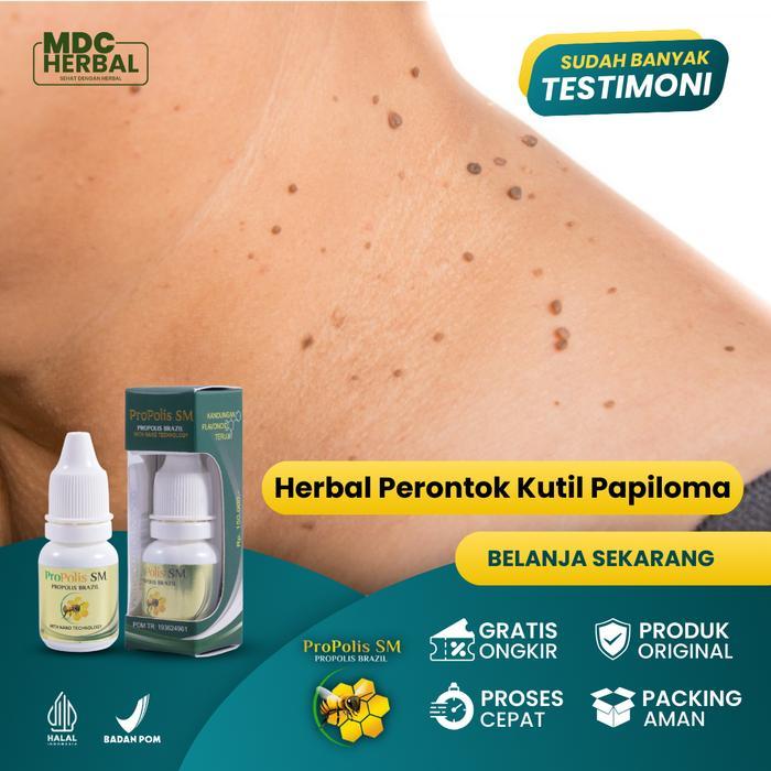 Perontok Kutil di Leher, Kutil Papiloma, Kutil Diwajah, Kutil Ditangan, Skin Tag, Penghilang Kutil,