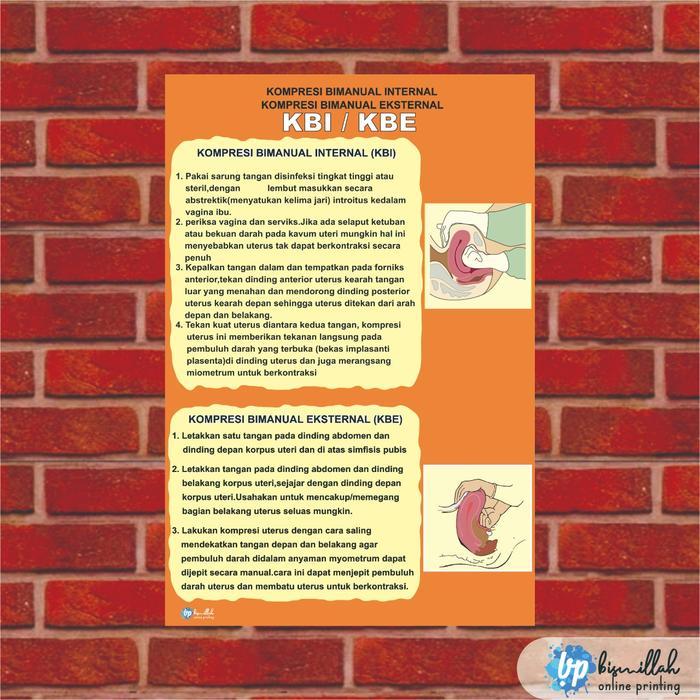 Poster Kebidanan KBI / KBE