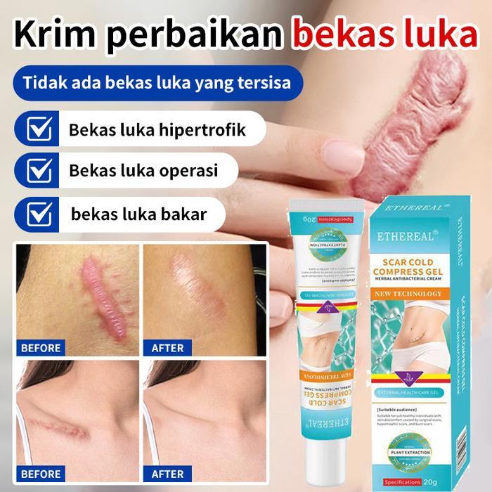 SALE Scar Formula Cream Salep Penghilang Bekas Luka / Keloid ANTI SCAR Cream Krim Digigit Serangga
