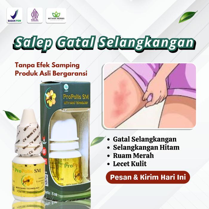 Salep Gatel2 Di Selangkangan Hitam Ruam Merah Lecet Kulit Bruntusan Mencerahkan Selangkangan Kusam