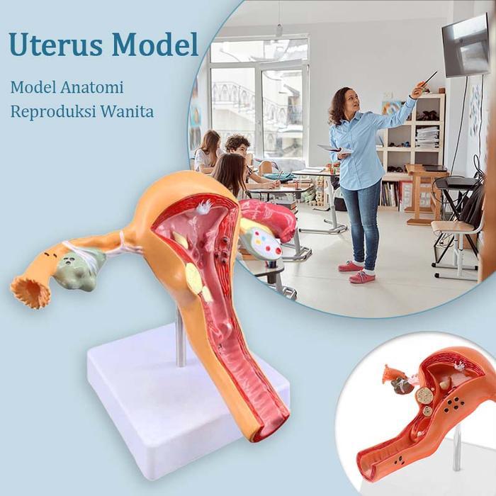 Uterus Ovary Anatomical Model Model Patologis Uterus Alat Peraga Pendidikan Uterus Alat Peraga