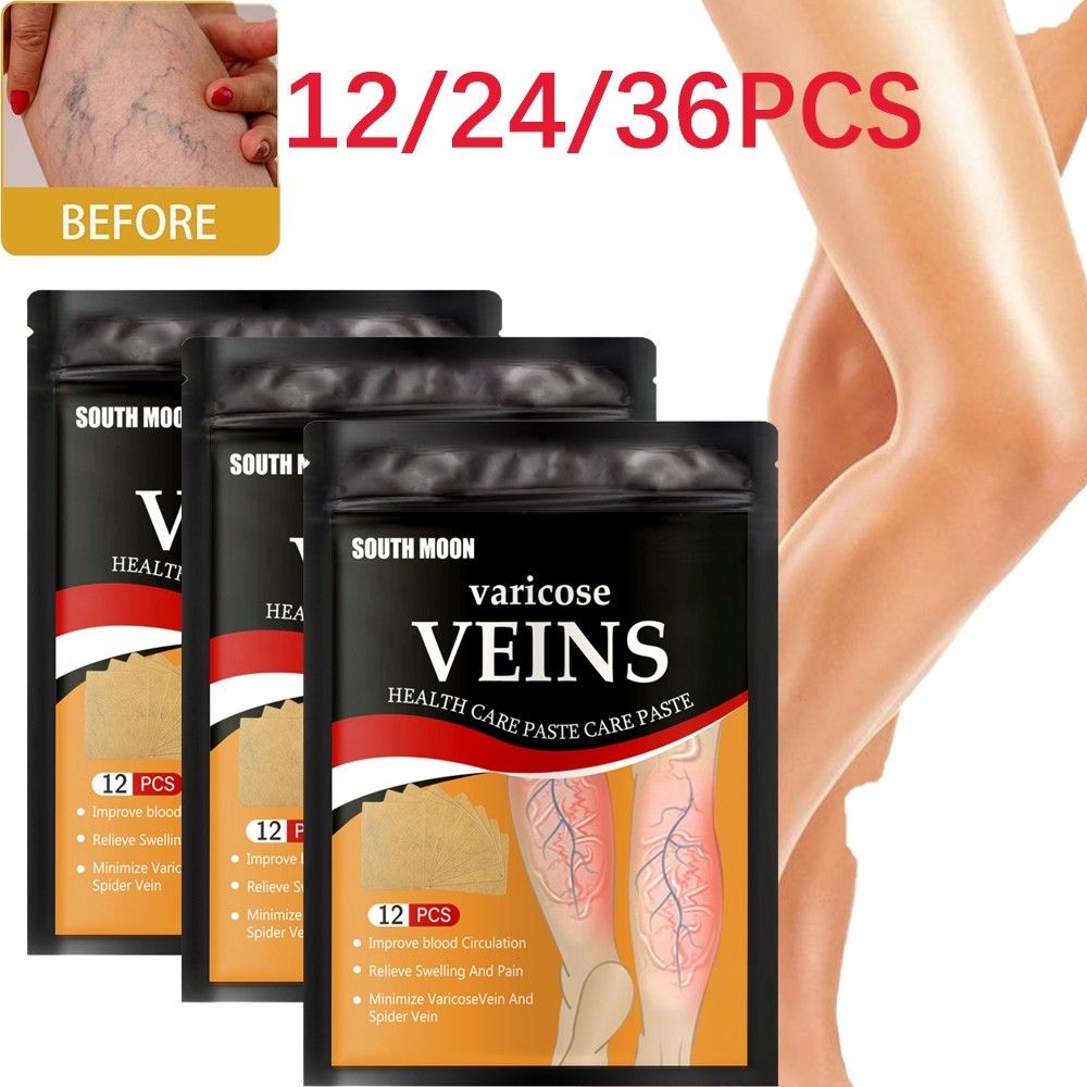 12/24/36PCS Varicose Veins Ointmnet Vasculitis Phlebitis Spider Cream Varicosity Angiitis Removal