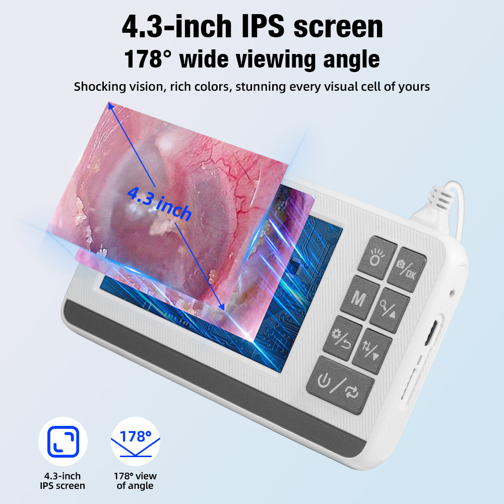 KERUI Otoscope 3.9mm Ear Endoscope Camera with 6 Lights 4.3 Inch Screen Ear Wax Removal Tool