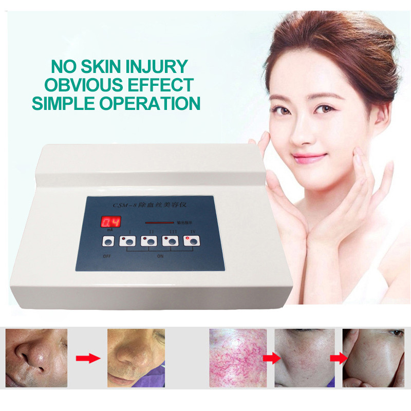 High Frequency Spider Veins Removal Device Remove Facial Thread Veins Red Blood Vessel Spots