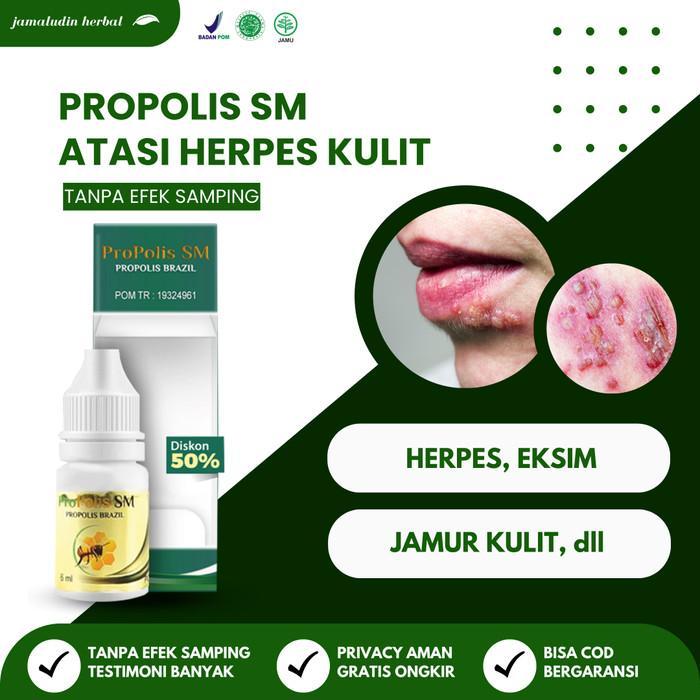 Propolis SM Salep Gatel Exim Kulit Kurap Panu Gatal Gatel