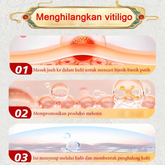 Salep vitiligo efektif mengobati bintik-bintik putih vitiligo bintik-bintik coklat bintik-bintik