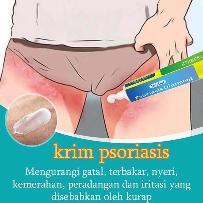 [Obat Gatal Terkuat]Obat gatal gatal kulit,Salep Gatal Psoriasis,Kaya Obat Herbal China,Esens