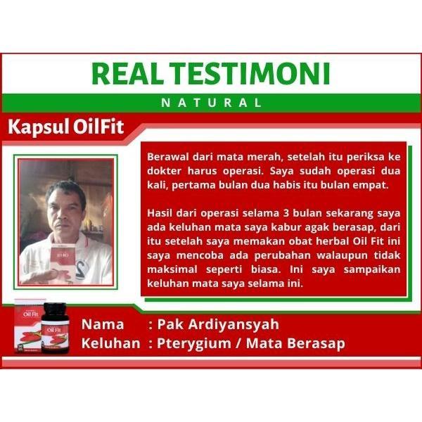 0Bat Mata Ptosis, Mata Beda Sebelah, Mata Sipit Sebelah, Kelopak Mata Turun, Mata Kecil Sebelah,