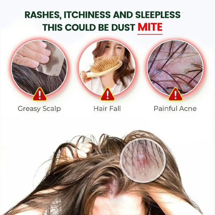 Obat Ketombe rambut Anti itching cream 20g Obat Psoriasis di Kepala Eksim Kepala gatal
