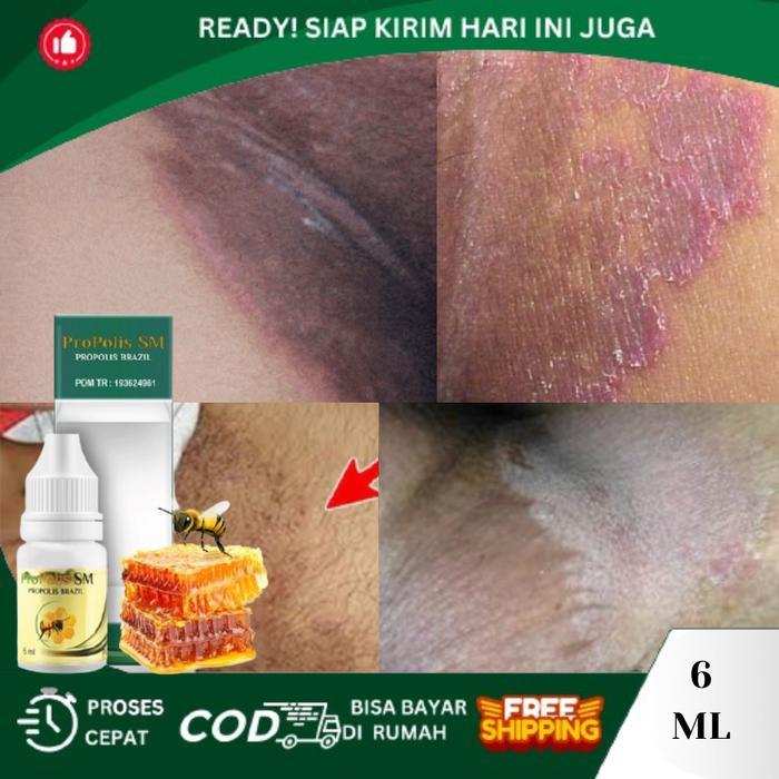 Lariss Maniss Selangkangan Hitam, Pemutih Selangkangan Alami, Salep Penghilang Selangkangan Hitam,