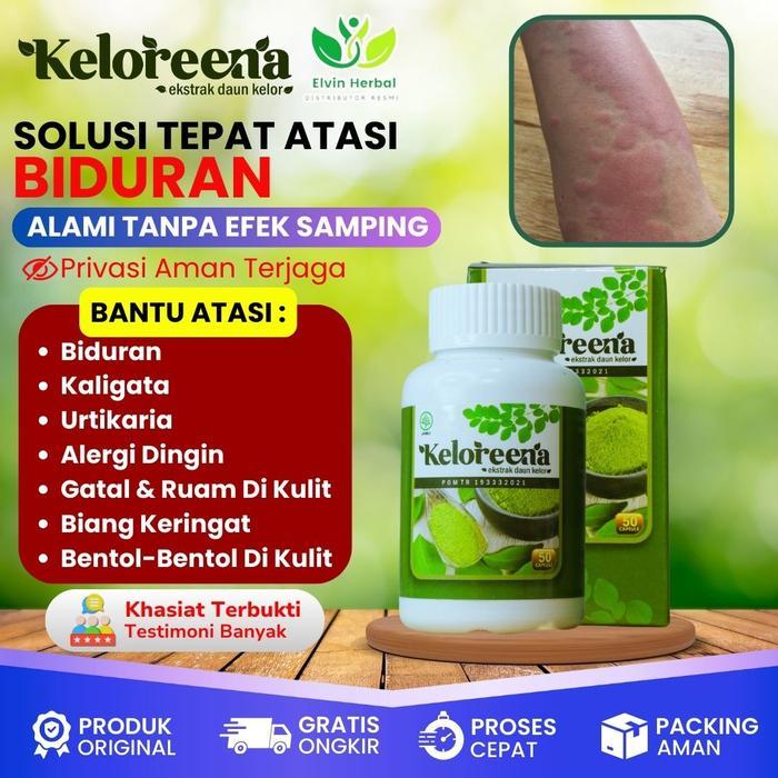 Terlaris Suplemen Untuk Biduran, Gatal Gatal, Biduran Menahun, Kaligata Menahun, Alergi Dingin,