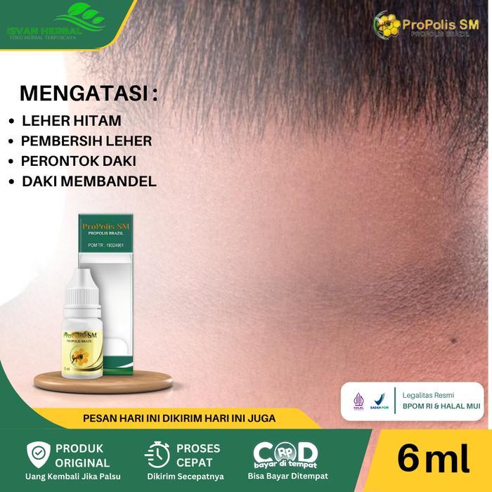 Lariss Maniss Propolis Sm Untuk Pemutih Leher Hitam, Memutihkan Tengkuk Leher Yang Hitam, Pemutih