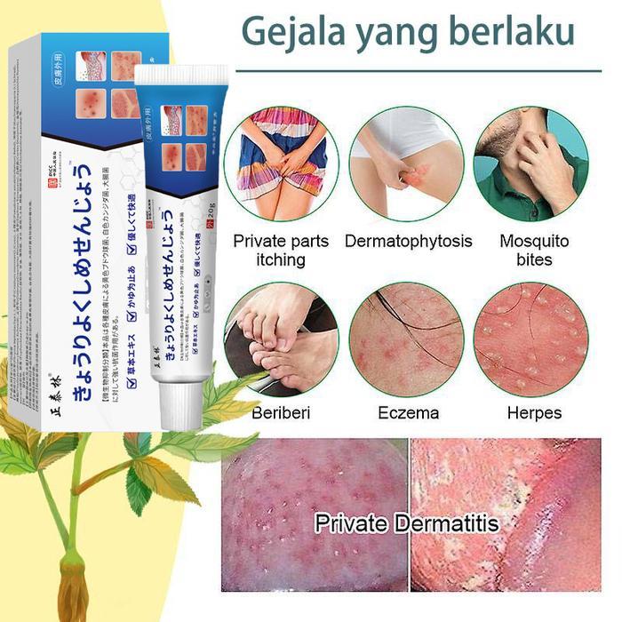 Salep gatal selangkangan Salep eksim Saleb gatal paling ampuh Menghilangkan Kurap dan Jamur