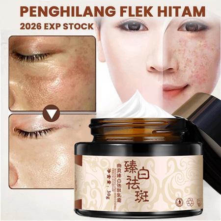 Cream Flek Hitam Membandel Cream Siang Malam Glowing Retinol Cream 30g Cream Penghilang Flek Hitam