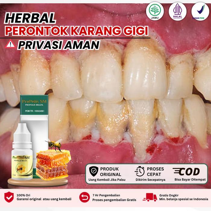 Promo Perontok Karang Gigi Menahun Dengan Propolis Sudah Bpom Dan Halal