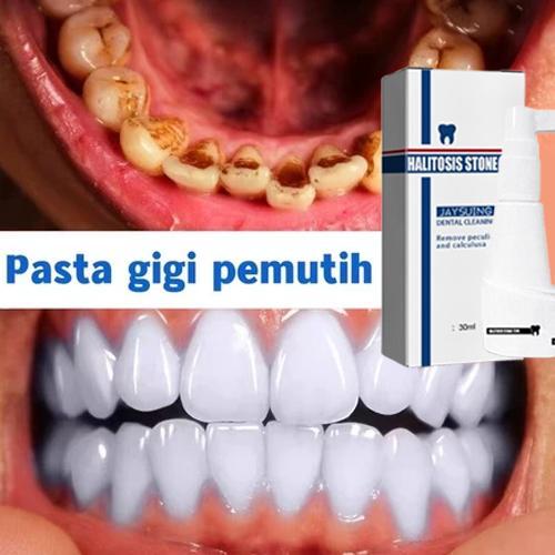 Perontok karang gigi paling ampuh Pembersih karang gigi Penghilang karang gigi Perontok karang gigi