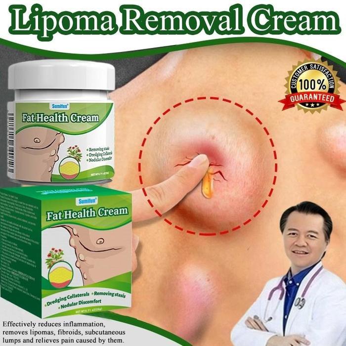 Lipoma cream Obat benjolan Obat lipoma 20g salep benjolan Obat Benjolan lipoma obat benjolan