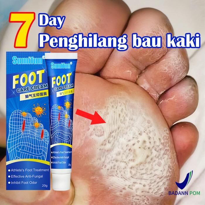 Obat Jamur Kaki Salep Penghilang Bau Kaki Anti Jamur Kaki Gatal&Kurap/Obat Jamur Kaki/Henti Gatal