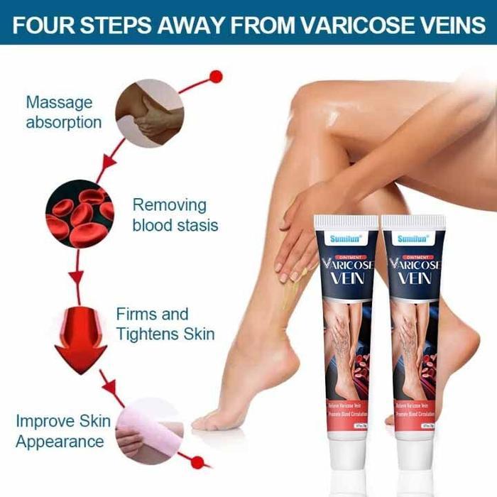 Obat varises Varicose veins cream Penghilang varises di kaki dan betis paling ampuh Krim Varises