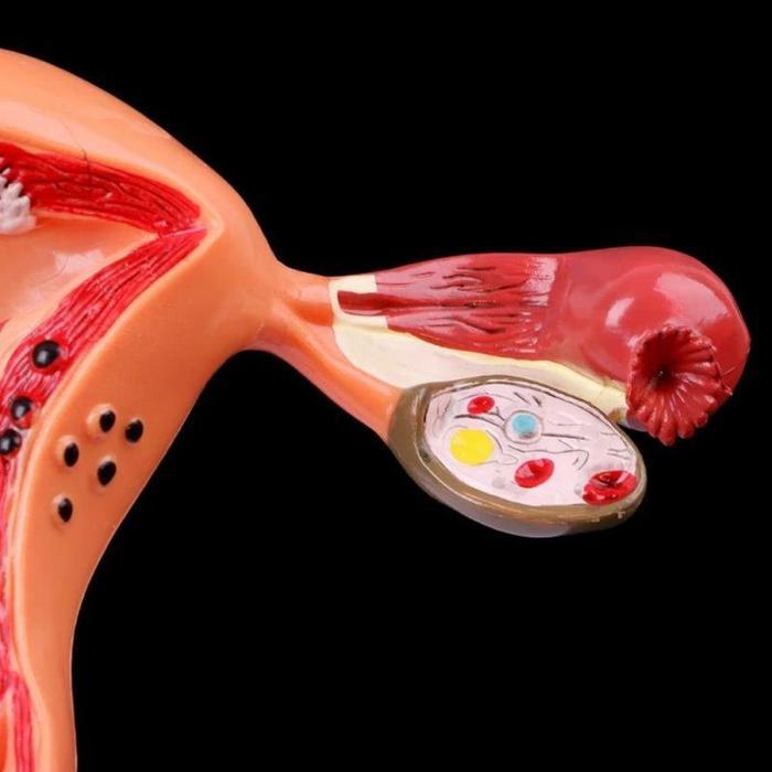 Uterus Ovary Anatomical Model Anatomy Alat Peraga Anatomi Model Patologis Uterus Ovarium Manekin