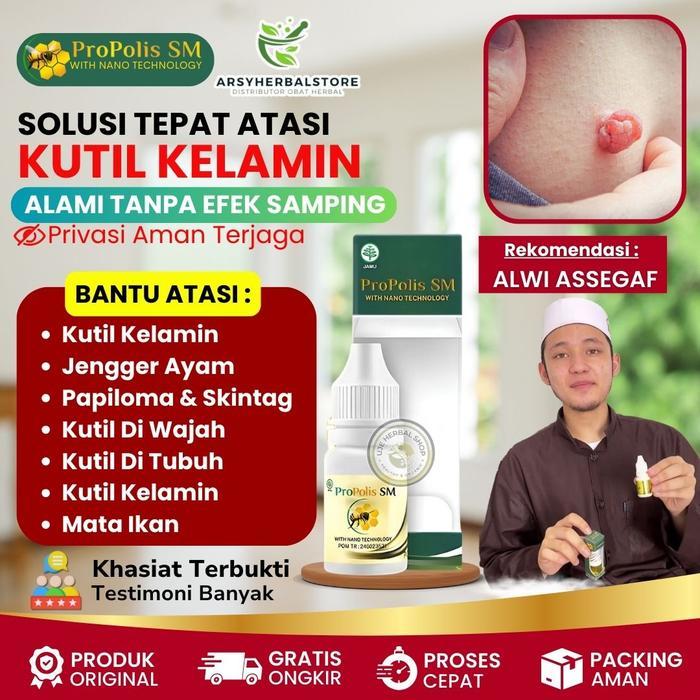 Terlaris Herbal Propolis SM Penghilang Kutil K3lamin, Jengger Ayam, Jamur K3lamin, HPV, Papiloma,