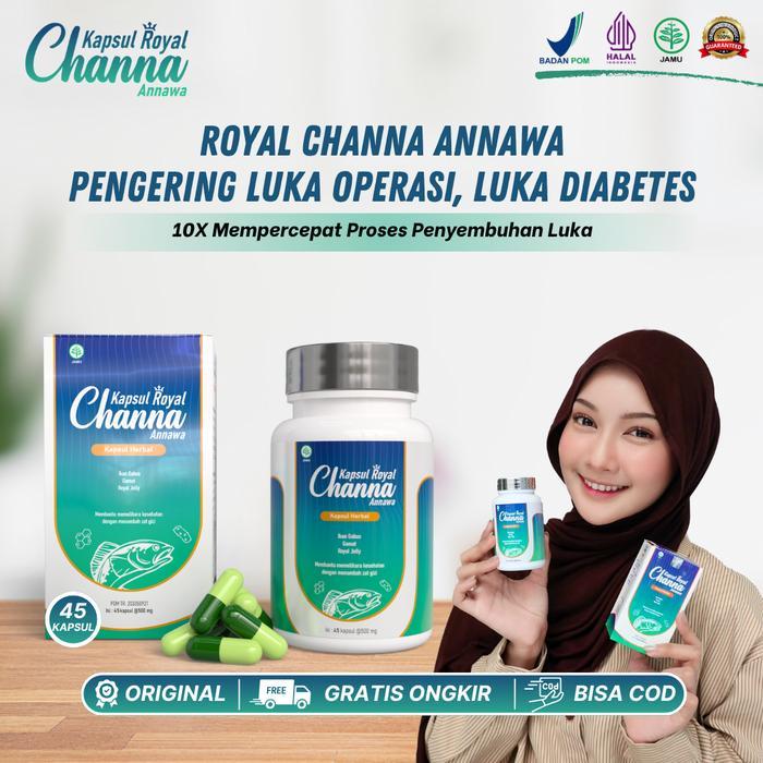 Royal Channa - Obat Pengering Luka Operasi, Cecar, Luka Diabetes, Luka Bakar, Bantu Mempercepat