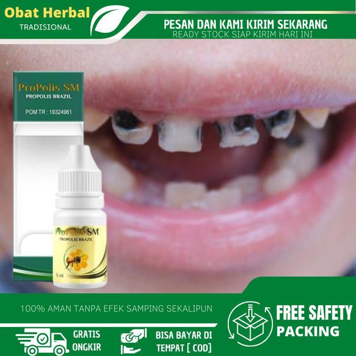 Promo Cairan Tetes Untuk Gigi Keropos, Sakit Gigi Berlubang, Sakit Gigi Nyut Nyutan, Gigi Bolong,