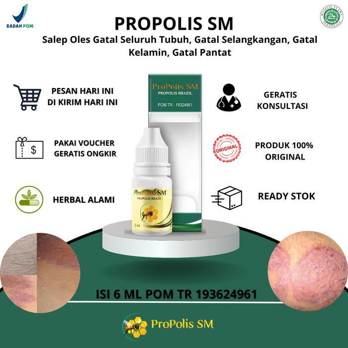 Lariss Maniss Propolis Sm Salep Oles Gatal Seluruh Tubuh, Gatal Selangkangan, Gatal Kelamin, Gatal