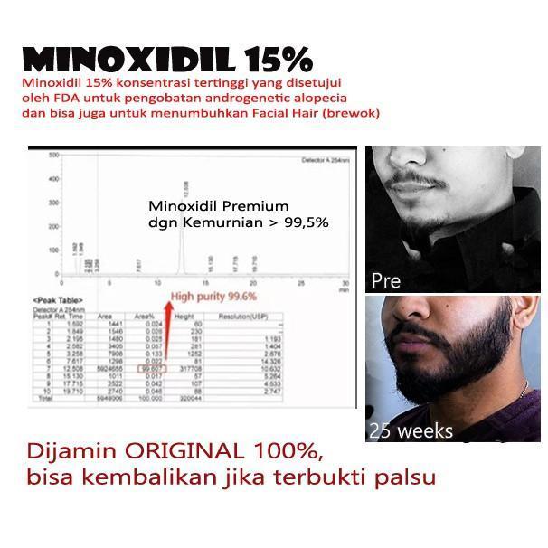 Minoxidil 15%, Penumbuh Brewok Dan Rambut ... New Arrival !!! Tbk
