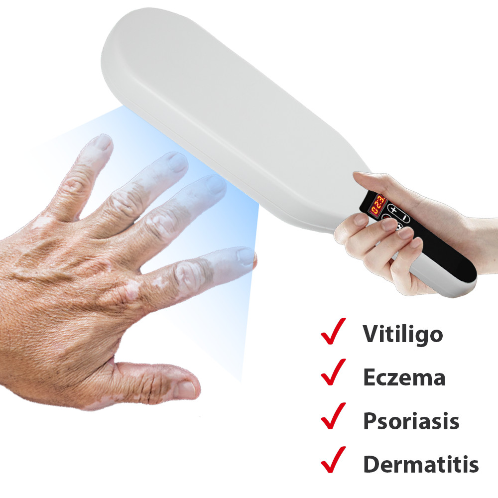 311nm Ultraviolet Phototherapy Instrument Double Lamp UVB Lamp for Vitiligo Treatment Psoriasis Lamp