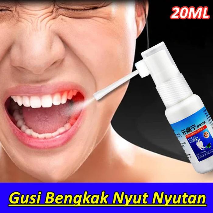 New Obat Sakit Gigi Berlubang Paling Ampuh Penghilang Gusi Bengkak Linu Ngilu Bernanah Nyeri