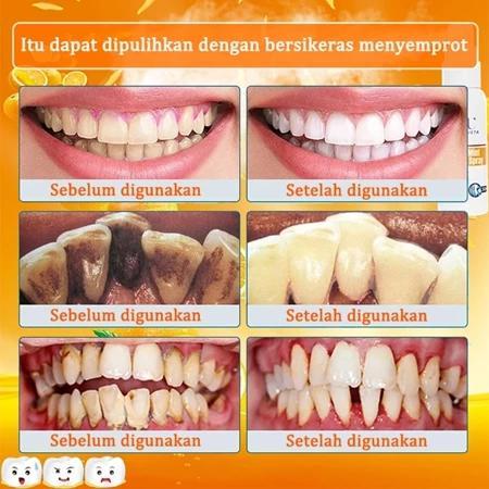 BPOMPerontok karang gigi paling ampuh Pembersih karang gigi berkerak karang gigi perontok 30ml