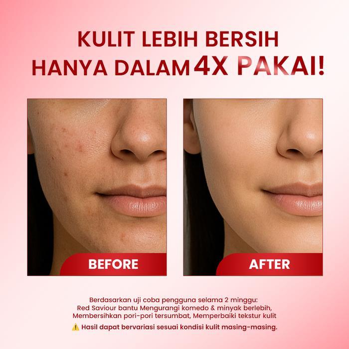 ready hot cleora beauty red saviour peeling solution serum skincare exfoliasi wajah berminyak with