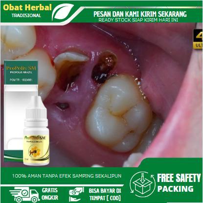 Promo Cairan Tetes Perontok Akar Gigi, Gigi Berlubang Agar Cepat Copot, Perontok Gigi Berlubang