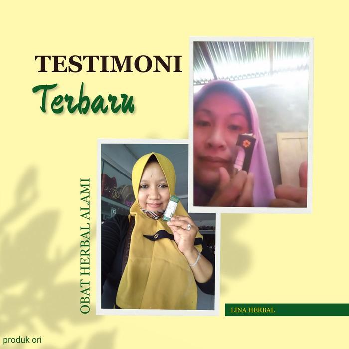 Propolis SM Perontok Akar Gigi Berlubang, Perontok Gigi Bolong, Penghilang Sisa Gigi Berlubang, gigi