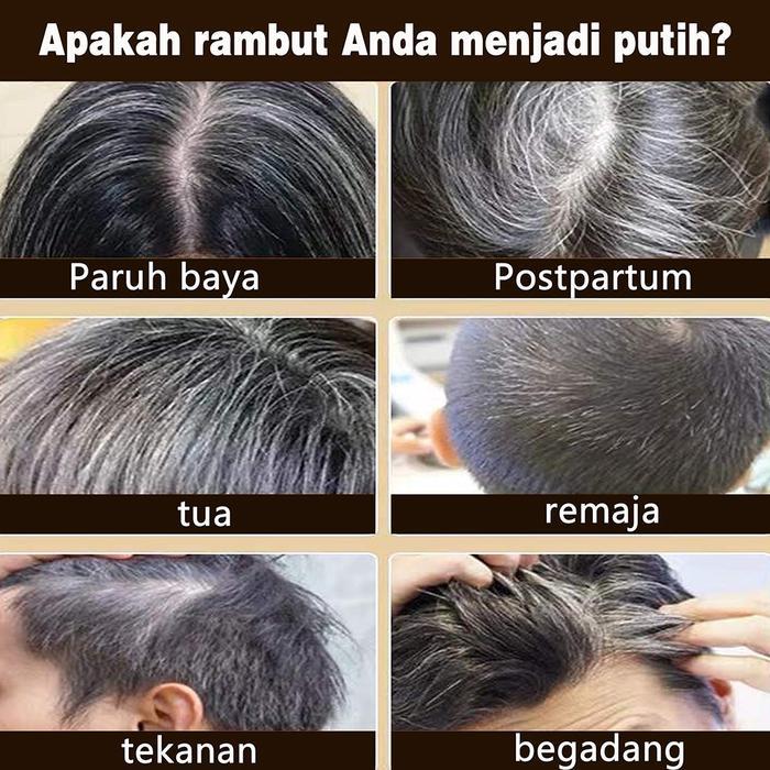 Sampo Penumbuh Rambut Jahe Hitam Mengontrol Minyak Sampo Perawatan Rambut Herbal / Shampoo Ginger