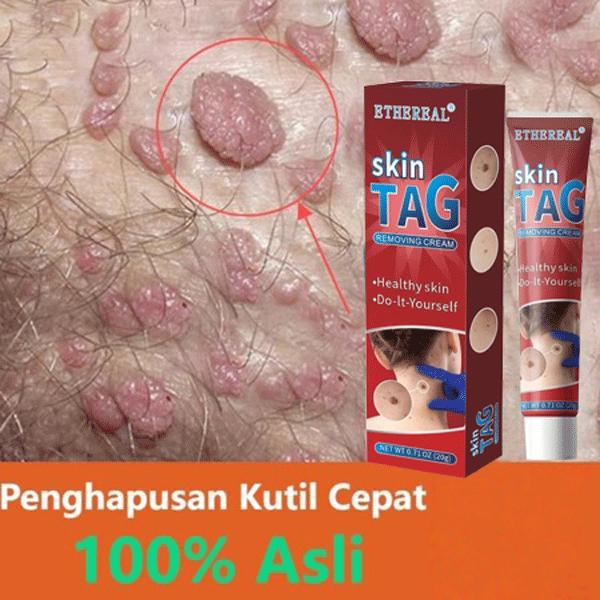 PRIVASI AMANObat Kutil Kelamin HPV, Obat Kutil Anus Pria / Wanita Perontok Kutil Kelamin Alami, Obat