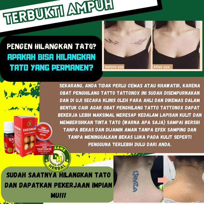 Salep Cream Krim Penghapus Penghilang Tato Tatoo Tatto Sulam Alis Permanen Tatonox Tattonox Original