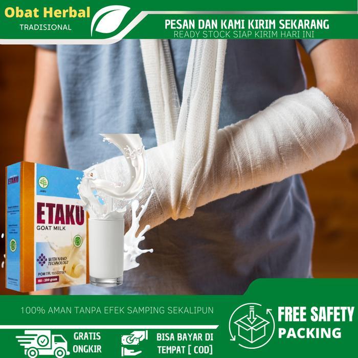 Etawaku Susu Patah Tulang, Tulang Retak, Osteoporosis, Susu Pengapuran Tulang, Susu Kalsium Untuk