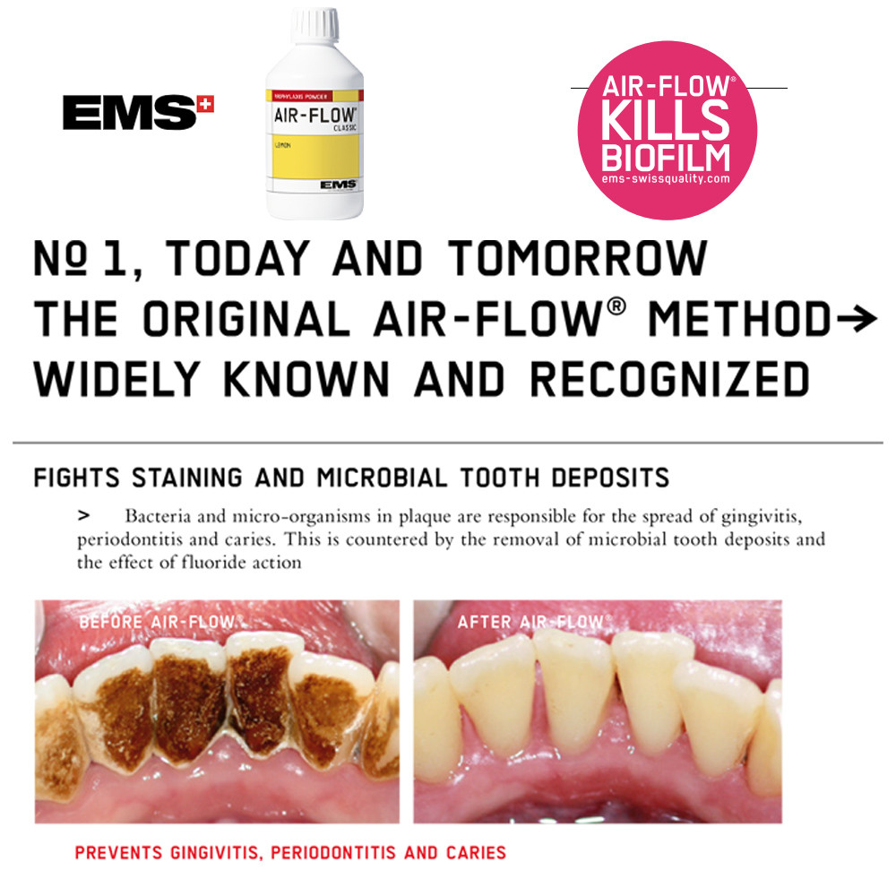 Dental Material EMS Prophylaxis Powder AirFlow Classic Lemon Teeth Cleaning Polishing Sandblasting