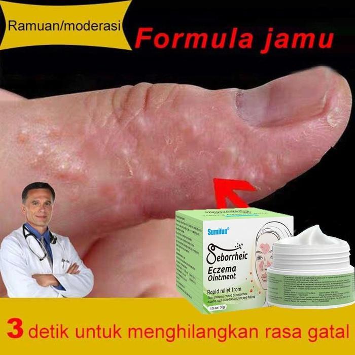 Salep Gatal Paling Ampuh Salep Eksim Cream Eksim Psoriasis Cream Ori Salep Eksim Kering Salep Gatal