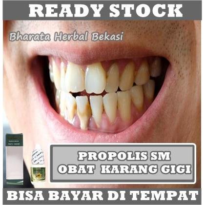 PROMO OBAT PEMUTIH GIGI, PENGHILANG PLAK KARANG GIGI, PEMBERSIH GIGI KUNING
