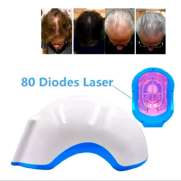 Helm Laser Penumbuh Rambut Topi Penumbuh Rambut Anti Rambut Rontok Perangkat Terapi Rambut Rontok