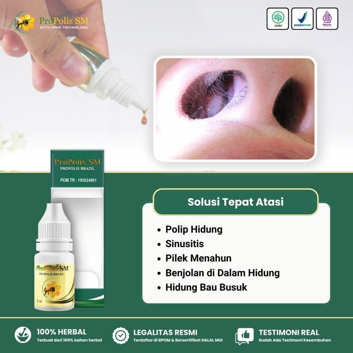 Propolis SM untuk Polip Hidung Sinusitis Pilek Menahun Hidung Gatal Bersin Bersin Hidung Bau Busuk