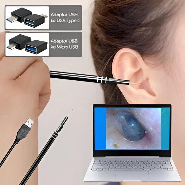 Kamera Endoskopi USB HD untuk Pembersih Telinga, Alat Pembersih Telinga dengan Kamera Endoscope