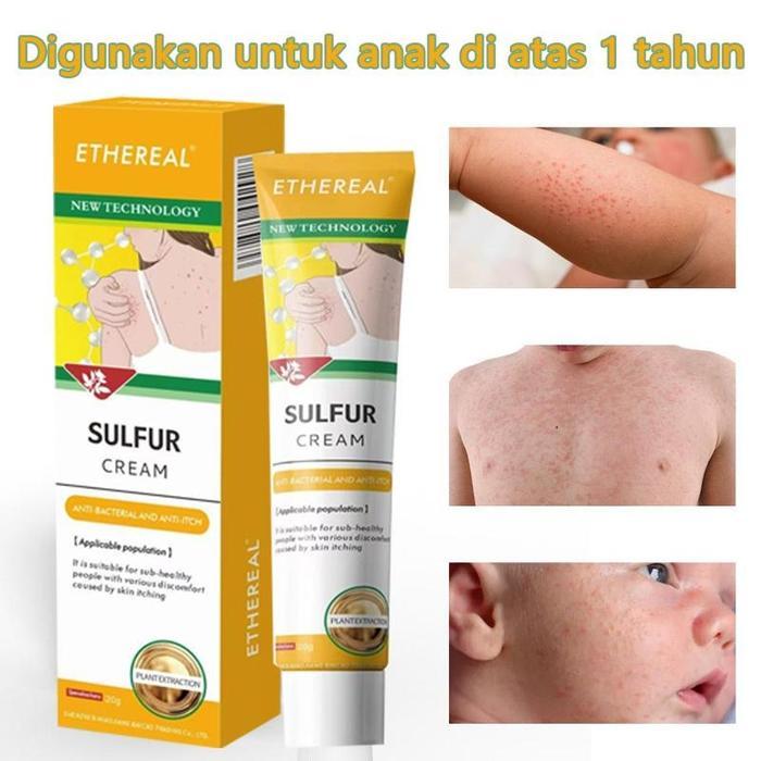 Salep Eksim Anak Salep Obat Salep Salep eksim anak krim popok untuk meredakan gatal Anti Gatal