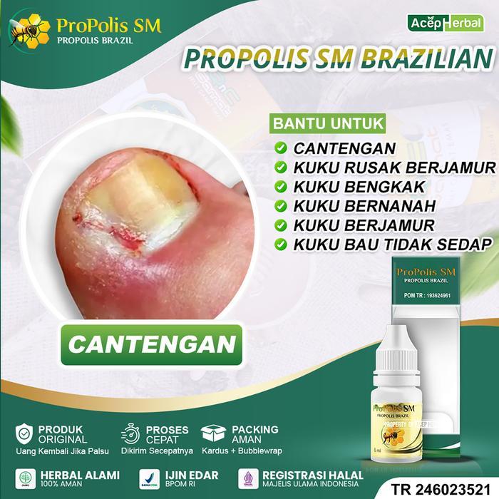 Sale Propolis Sm Oles Kuku Cantengan Kaki Tangan Berjamur Berdarah Bengkak Bernanah Bau Propolis Sm